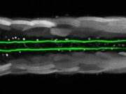 Scientists discover extraordinary regeneration of neurons