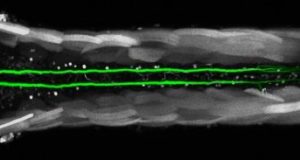 Scientists discover extraordinary regeneration of neurons