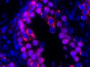 Sperm discovery reveals clue to genetic immortality