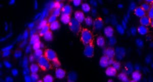 Sperm discovery reveals clue to genetic immortality