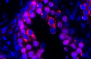 Sperm discovery reveals clue to genetic immortality