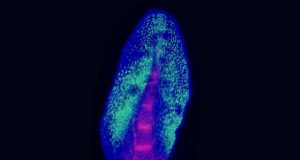 Lungfish fins reveal how limbs evolved