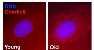 Study finds clues to aging in junk DNA