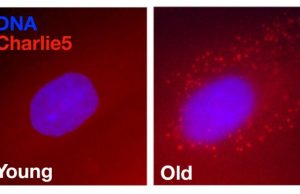 Study finds clues to aging in junk DNA