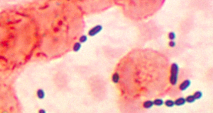 Customizable synthetic antibiotic outmaneuvers resistant bacteria