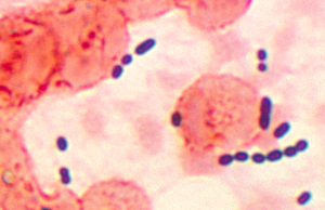 Customizable synthetic antibiotic outmaneuvers resistant bacteria