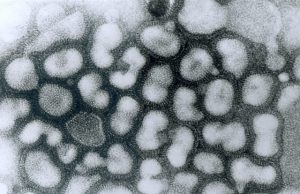 A step toward a universal flu vaccine