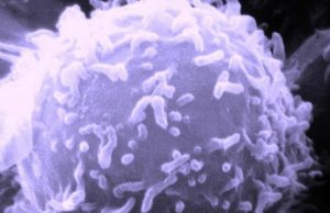 New nanotechology design provides hope for personalized vaccination for treating cancer