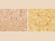 Does the human brain resemble the Universe