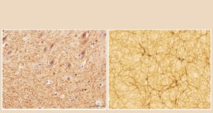 Does the human brain resemble the Universe