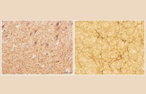 Does the human brain resemble the Universe