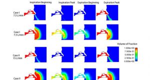 Face masks slow spread of COVID 19 types of masks length of use matter