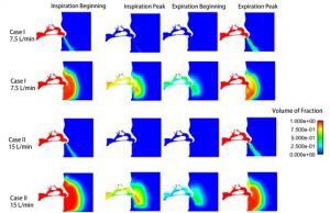 Face masks slow spread of COVID 19 types of masks length of use matter