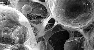 Researchers 3 D print biomedical parts with supersonic speed