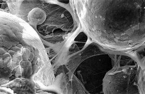 Researchers 3 D print biomedical parts with supersonic speed