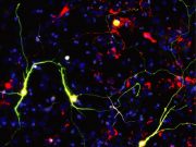Researchers improve neuronal reprogramming by manipulating mitochondria