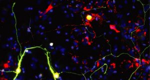 Researchers improve neuronal reprogramming by manipulating mitochondria