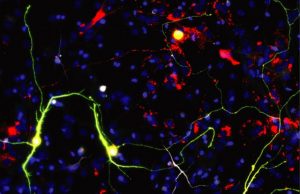 Researchers improve neuronal reprogramming by manipulating mitochondria