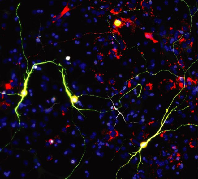 Researchers improve neuronal reprogramming by manipulating mitochondria