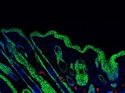 Wound healing biomaterials activate immune system for stronger skin