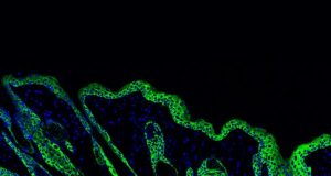 Wound healing biomaterials activate immune system for stronger skin