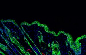 Wound healing biomaterials activate immune system for stronger skin