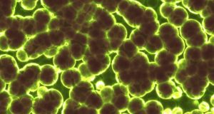 A simple rule drives the evolution of useless complexity