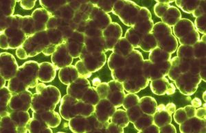 A simple rule drives the evolution of useless complexity A simple rule drives the evolution of useless complexity