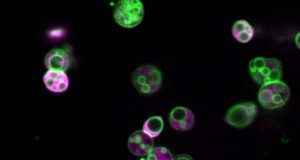 Hidden structure found in essential metabolic machinery