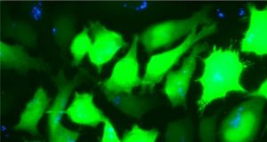 Researchers discover new way to deliver DNA based therapies for diseases