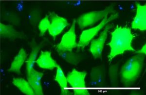 Researchers discover new way to deliver DNA-based therapies for diseases Researchers discover new way to deliver DNA based therapies for diseases