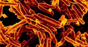 Scientists discover potential method to starve the bacteria that cause tuberculosis