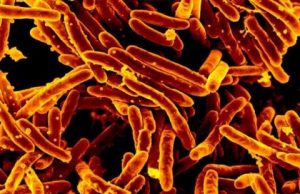 Scientists discover potential method to starve the bacteria that cause tuberculosis Scientists discover potential method to starve the bacteria that cause tuberculosis