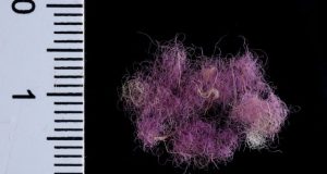 A glimpse into the wardrobe of King David and King Solomon 3000 years ago