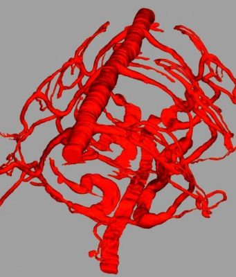 A single gene ‘invented’ hemoglobin several times A single gene invented hemoglobin several times