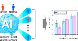 Cancer can be precisely diagnosed using a urine test with artificial intelligence