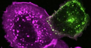SARS CoV 2 needs cholesterol to invade cells and form mega cells