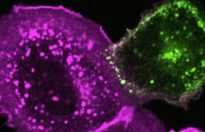 SARS CoV 2 needs cholesterol to invade cells and form mega cells
