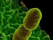 Scientists identify nutrient that helps prevent bacterial infection