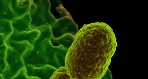Scientists identify nutrient that helps prevent bacterial infection