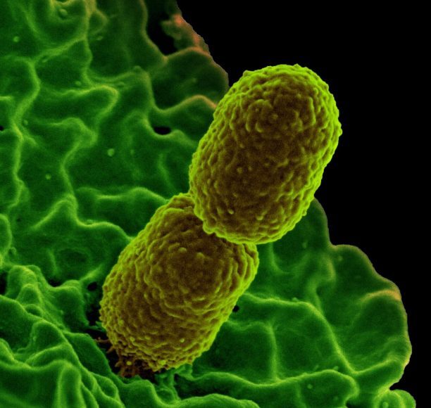 Scientists identify nutrient that helps prevent bacterial infection