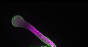 Membrane building blocks play decisive role in controlling cell growth