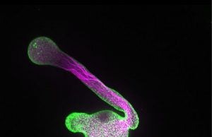 Membrane building blocks play decisive role in controlling cell growth