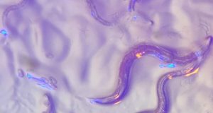 Roundworms read wavelengths in the environment to avoid dangerous bacteria that secrete colorful toxins
