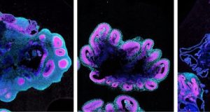 Scientists discover how humans develop larger brains than other apes