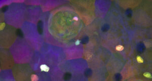 Discovery of an elusive cell type in fish sensory organs