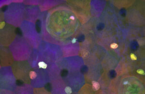 Discovery of an elusive cell type in fish sensory organs