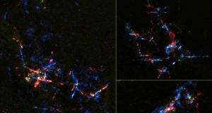 Stellar eggs near galactic center hatching into baby stars