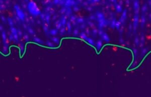 A physics perspective on wound healing