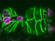 Biologists discover a trigger for cell extrusion